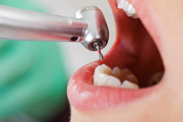 Best Walk-In Emergency Dentist in Cerritos, CA